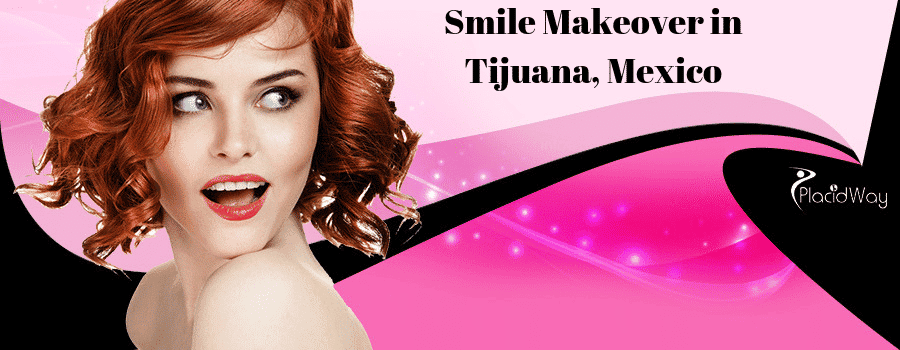 10 Best Questions to Ask Before Going For Smile Makeover in Tijuana, Mexico